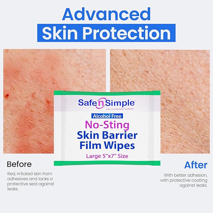 Safe n' Simple Skin Barrier Wipes - 25 Large 5” x 7” Individually Wrapped No-Sting Barrier Film - Skin Prep Protective Wipes - Medical Bandage Barrier Film for Skin