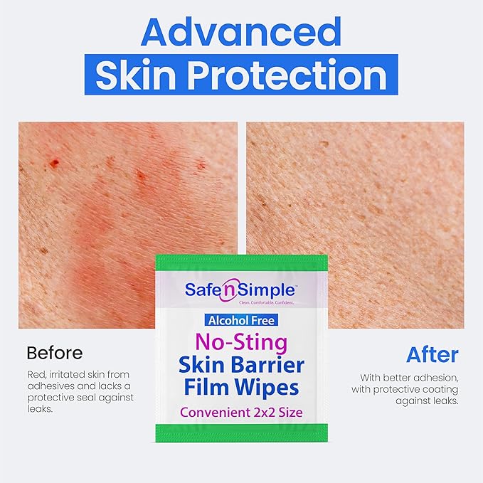 Safe n' Simple No Sting Skin Prep Wipes - 100 Individual Ostomy Barrier Film 2.4" x 2.4" - Skin Barrier Film Wipes for Ostomy - Protective Sting Free Skin Barrier