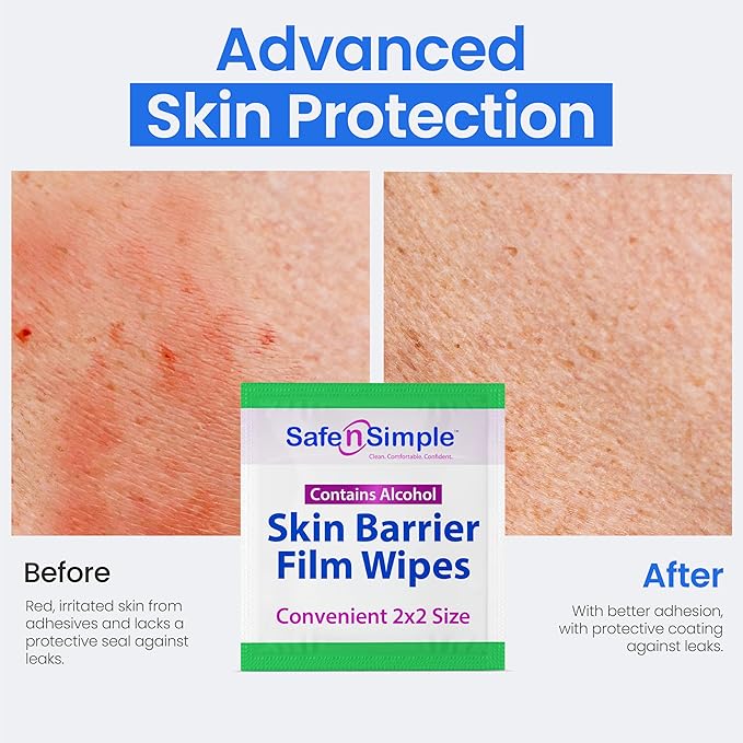 Safe n' Simple Skin Barrier Wipe with Alcohol - 50 Individually Packaged Wipes 2"x2" - Ostomy Sterile Skin Prep Pads - Skin Barrier Film Wipes for Ostomy - Alcohol Stoma Barrier Prep Pads